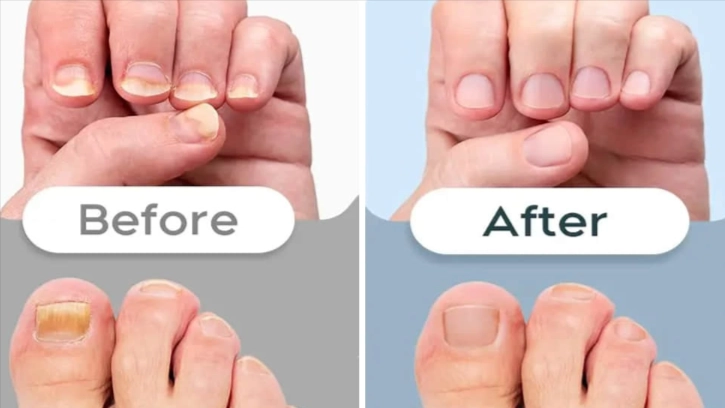Hewelth BioClear Nails Customer Reviews